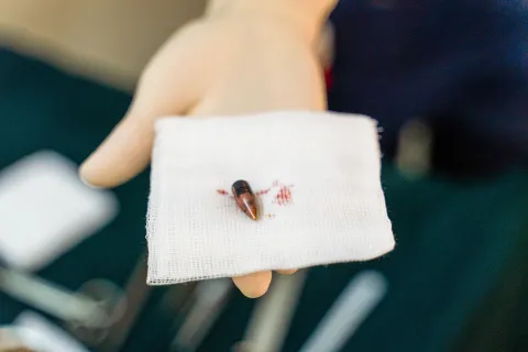 Kula från ett handeldvapen på en gasbinda med spår av blod, framhållen av en hanskbeklädd hand
